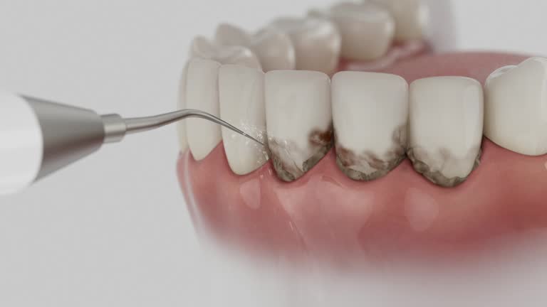 Trusted Teeth Cleaning And Checkup service in Killeen, TX - Dentist Open Now